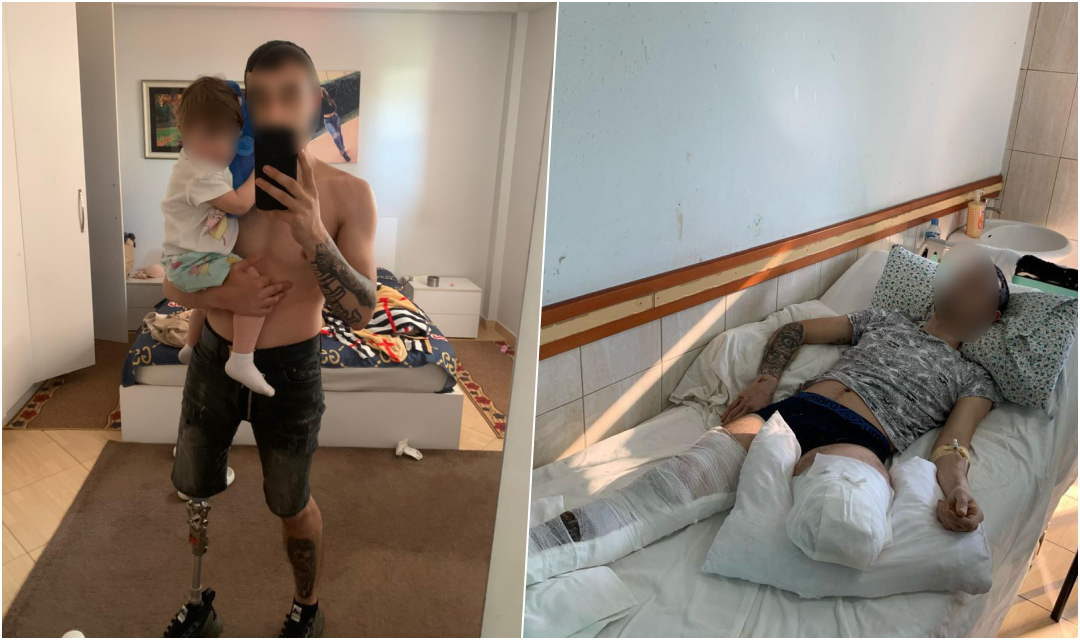 Ka njërën këmbë me protezë, babai i vogëlushes 2-vjeçare ka nevojë për një vend pune