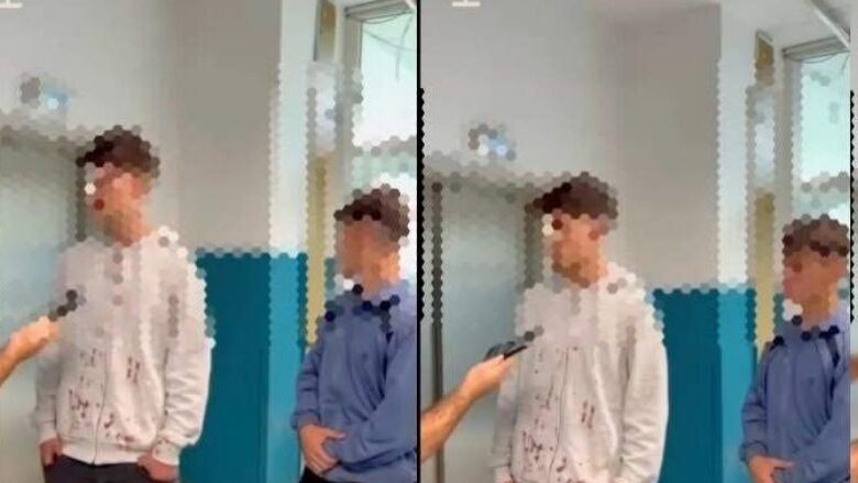 Policia thotë se ka zbardhur rrahjen brutale të dy të rinjëve shqiptarë nga maqedonasit në Tetovë