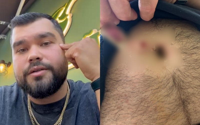 Pas plagosjes në Tiranë, sipërmarrësi amerikani apel rinisë shqiptare: Zgjidhni jetën, jo krimin!