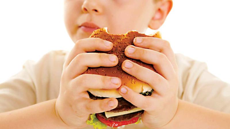 17% e fëmijëve nën 5-vjeç në Shqipëri janë obezë