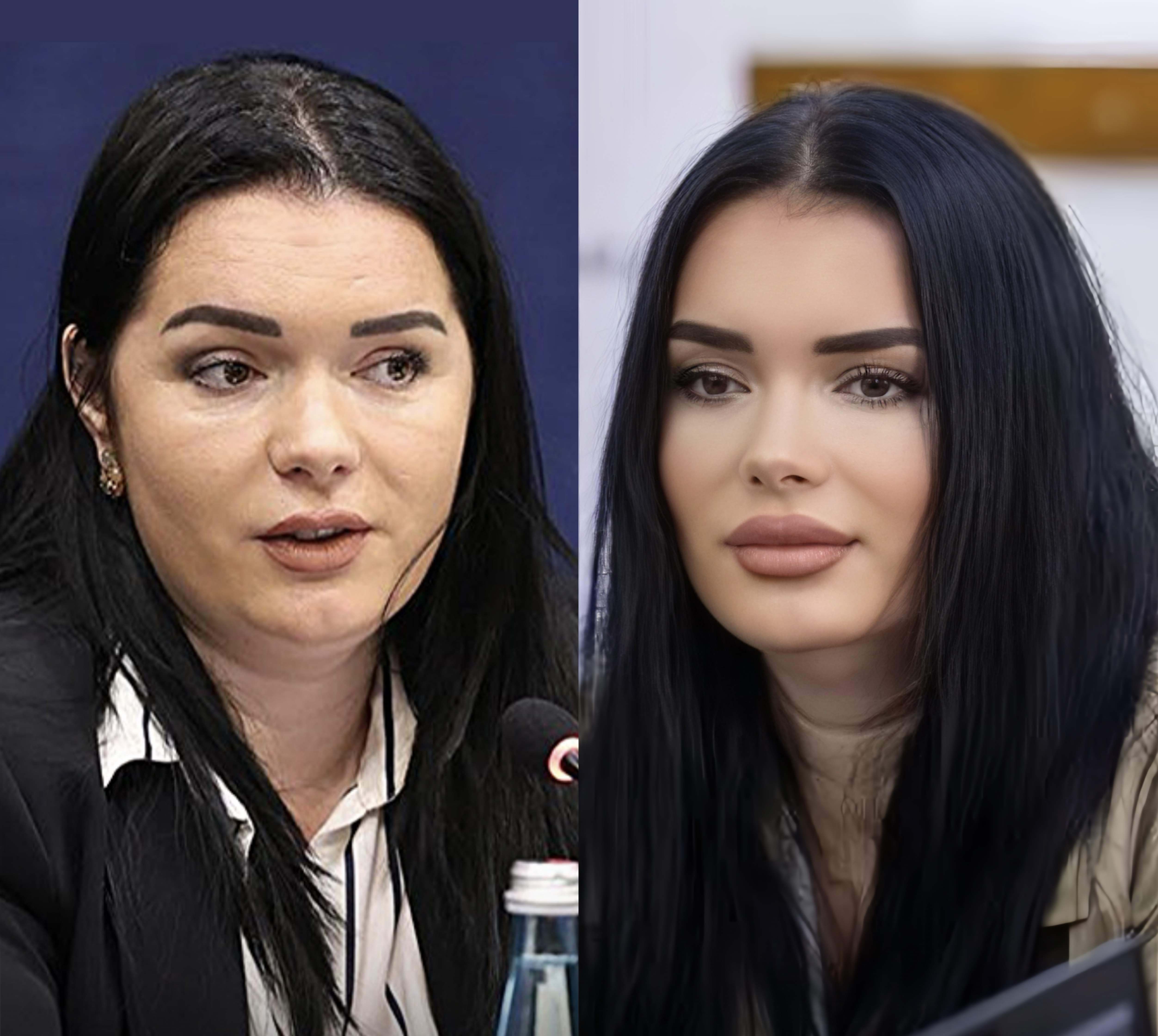 Linda, drejtoresha e botoksit për SPAK! I jep 300 Milion Lekë Thomait për servis ambulancash