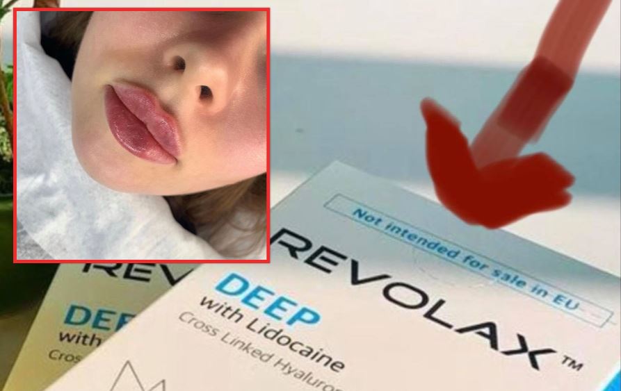 Dogana e Kosovës ndalon produkte estetike botox dhe fillerë pa dokumente, vlera rreth 5 mijë euro
