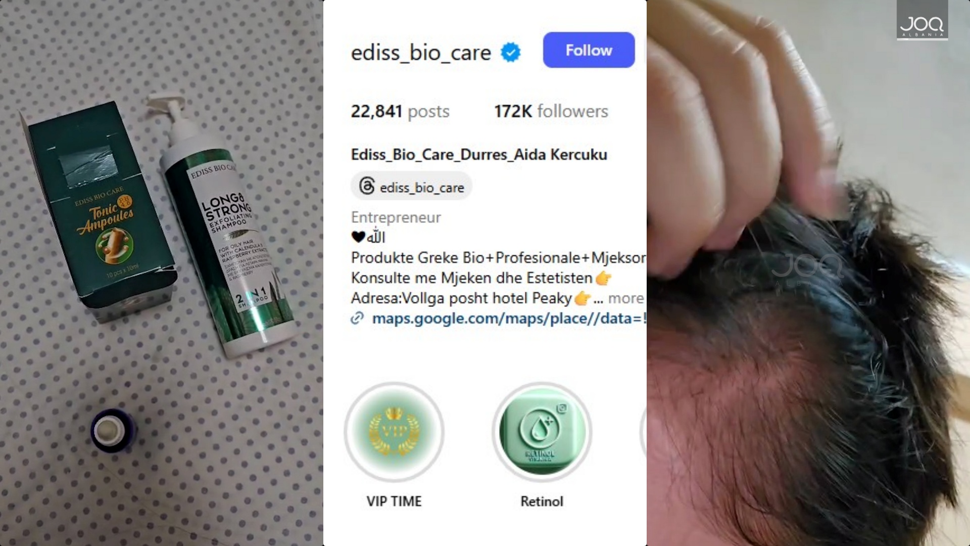 150 euro të shkuara dëm, vajza denoncon dyqanin e produkteve kozmetike