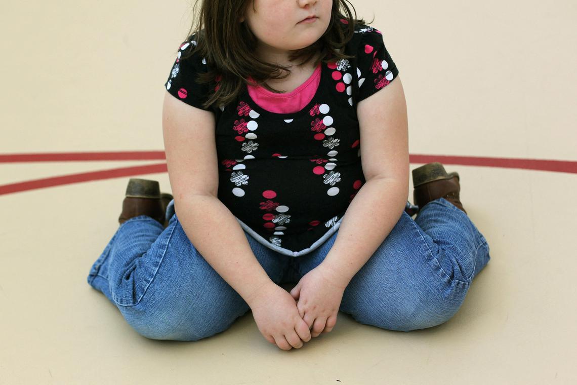 UNICEF: Më shumë fëmijë janë obezë sesa nënpeshë