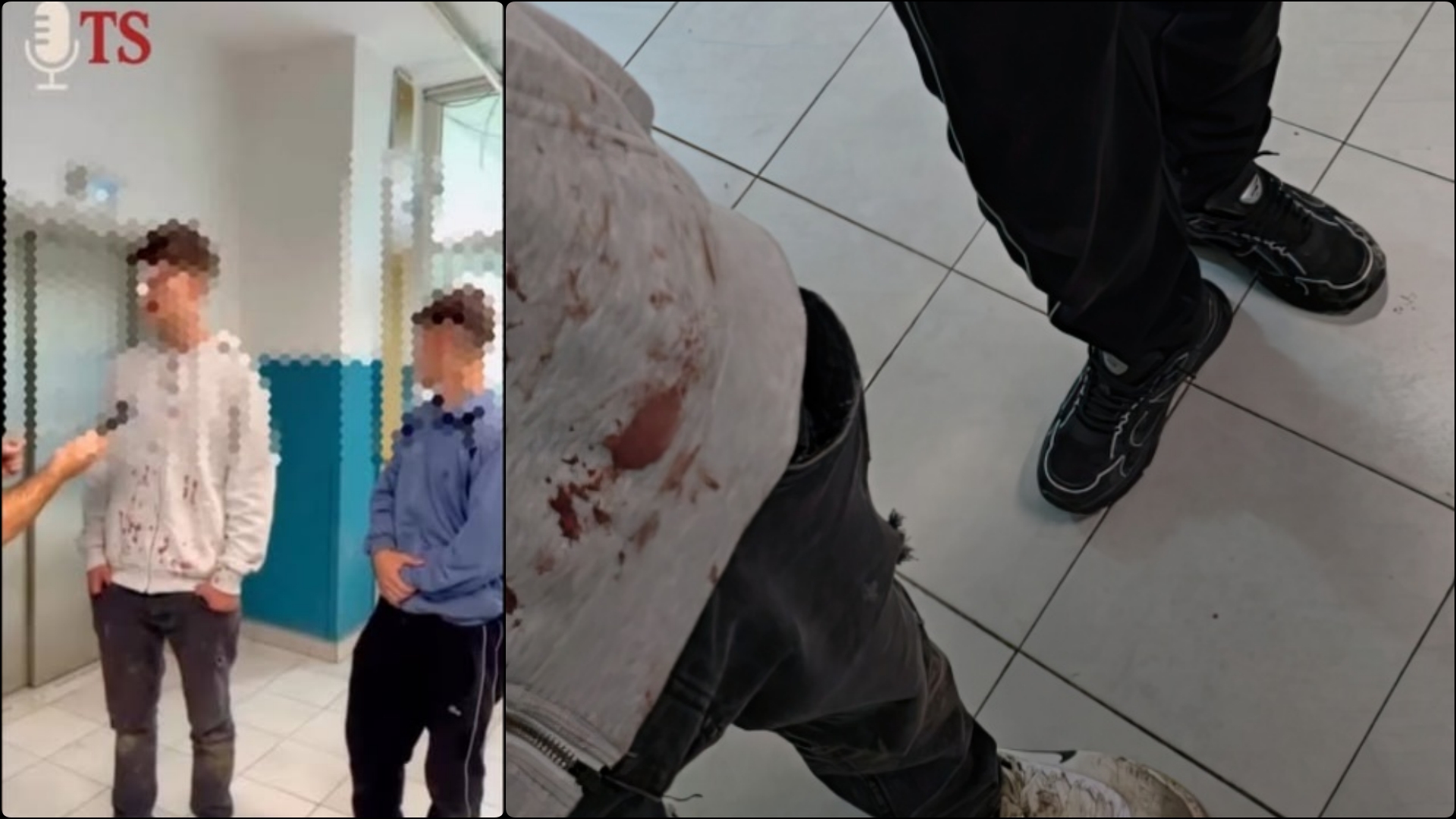 Sulmohet brutalisht dy nxënës shqiptarë në Tetovë nga tifozë të “VOJOVODËS”