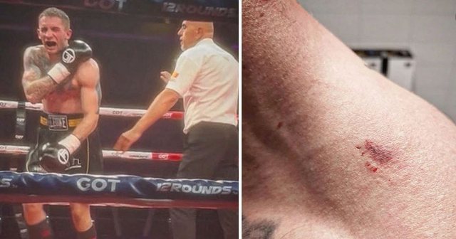 Belgjikë, boksieri shqiptar kafshon kundërshtarin serb, por fiton ndeshjen!