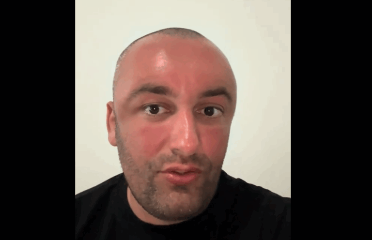 Samedi denoncon publikisht, shfaqet i “stërkuqur” nga botoxi në Kosovë