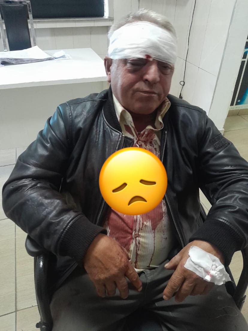 Dy persona rrahin brutalisht punonjësin e pastrimit në Vlorë