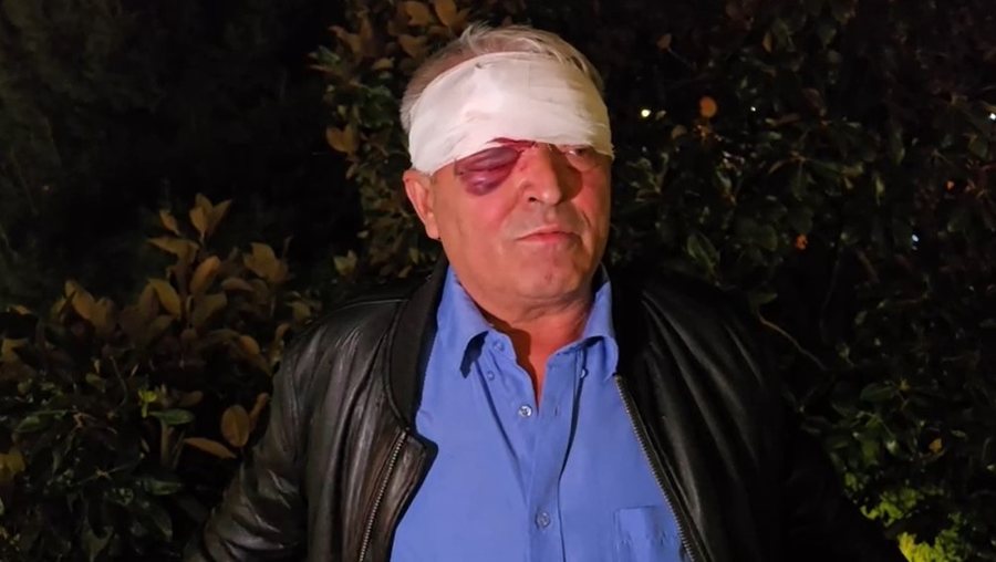 “S’i kam borxh askujt”, flet qytetari i dhunuar në Vlorë: Askush s’ndërhyri për mua