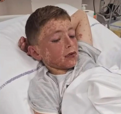 Medikamenti mjekësor i shkaktoi sindromën e rrallë, vogëlushi 12-vjeçar ka nevojë urgjente për ndihmë