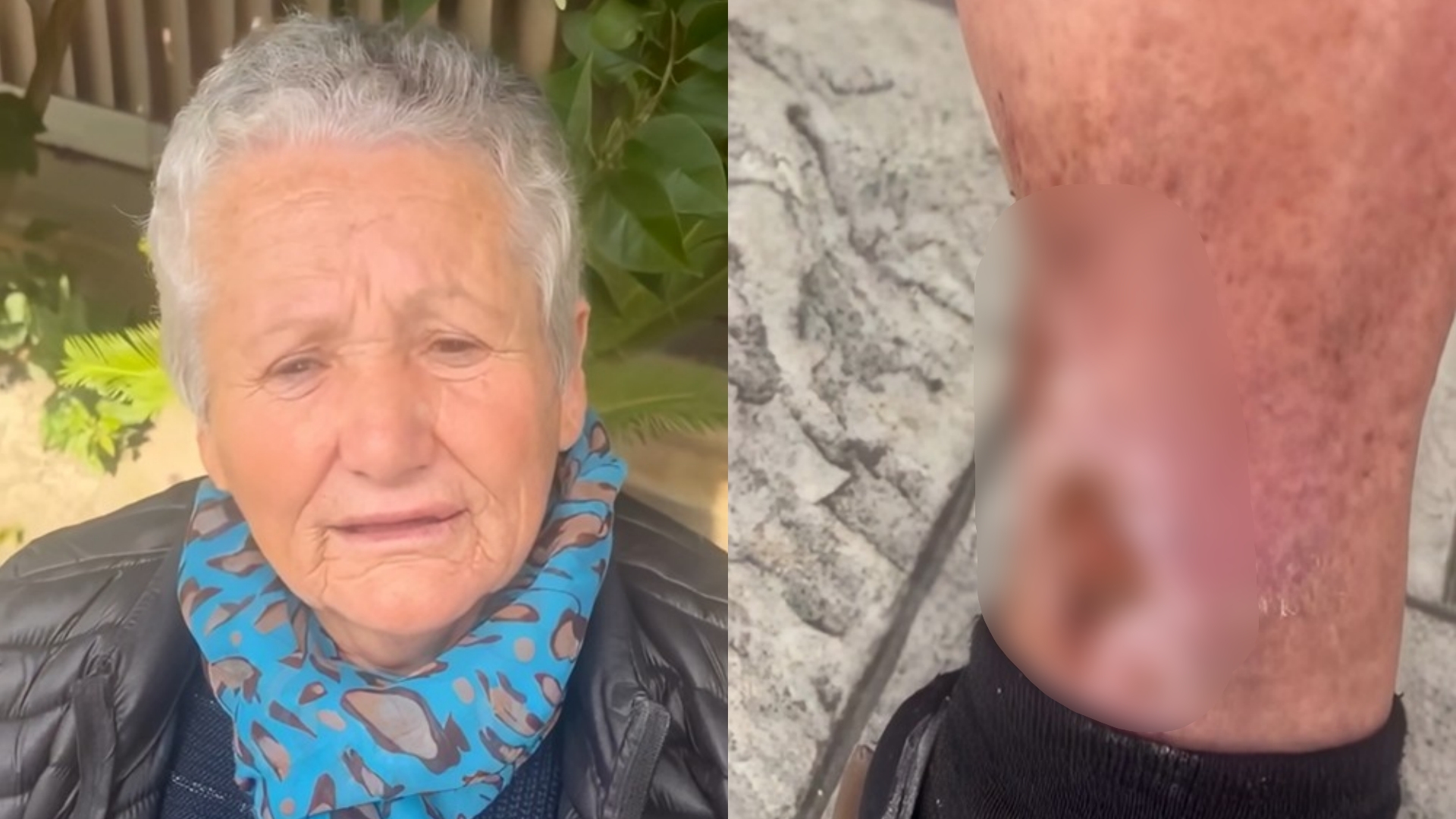 E sëmurë dhe e braktisur, nënë Elsa ka nevojë për ndihmën tuaj