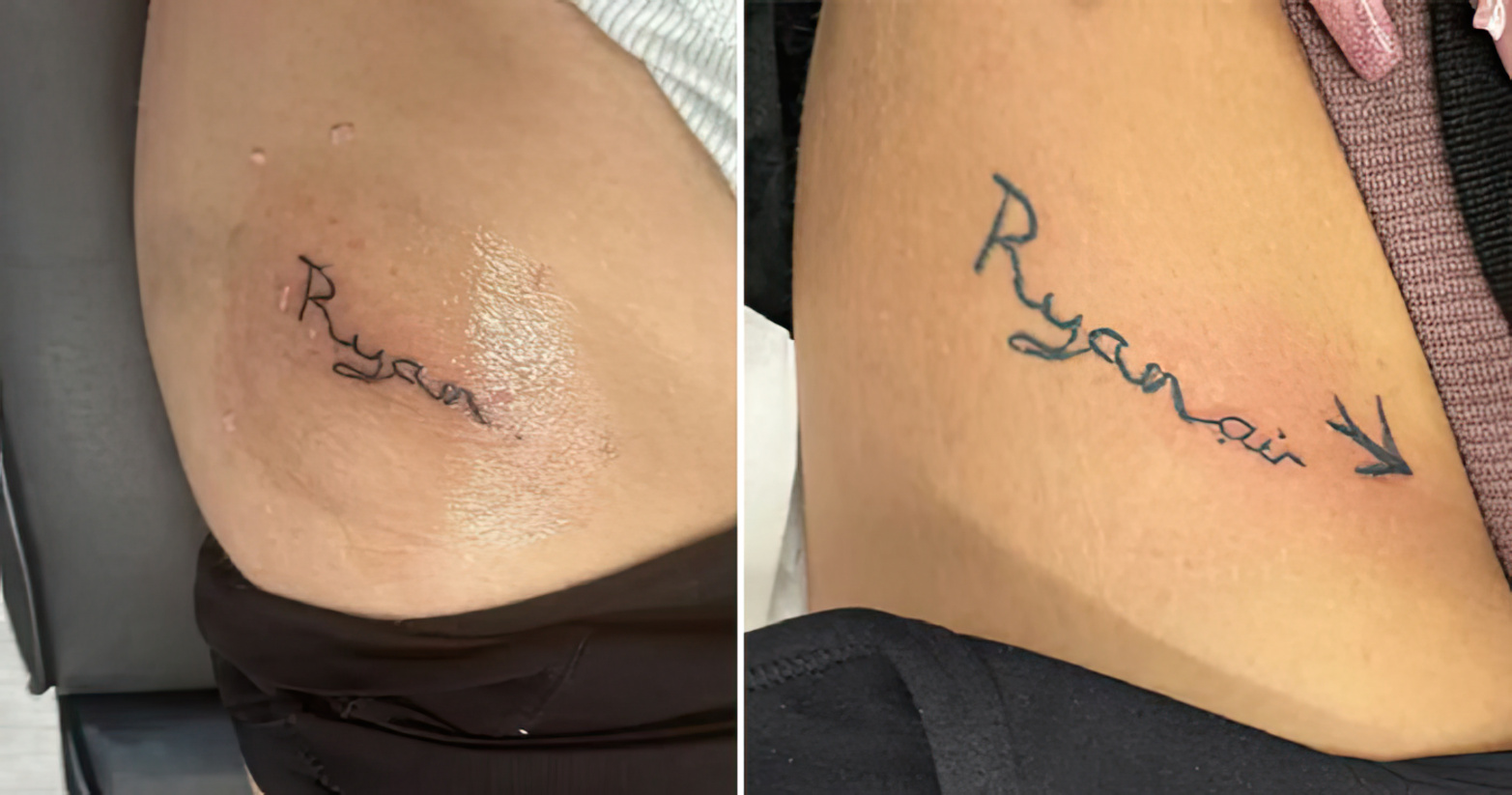 Vajza britanike e kthen tatuazhin e ish-it në “Ryanair” pas ndarjes