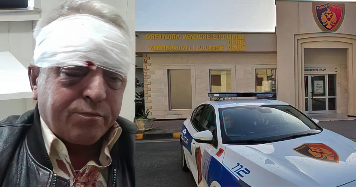 Dhunuan me leva punëtorin e pastrimit, arrestohen dy persona në Vlorë