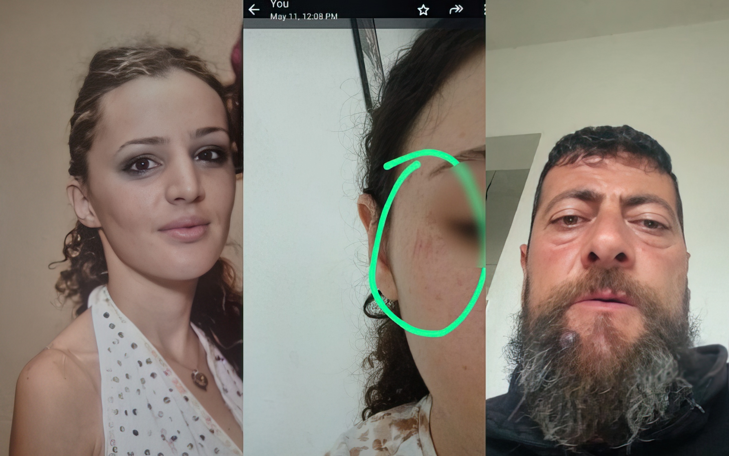 Nëna dhunon vajzën për të burgosur ish-burrin, edukatore në Tiranë