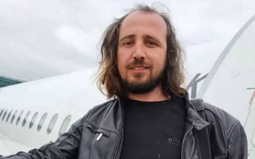 Tronditëse: Shqiptari 36-vjeçar vdes në Stamboll pas mbjelljes së flokëve dhe implantit të dhëmbëve