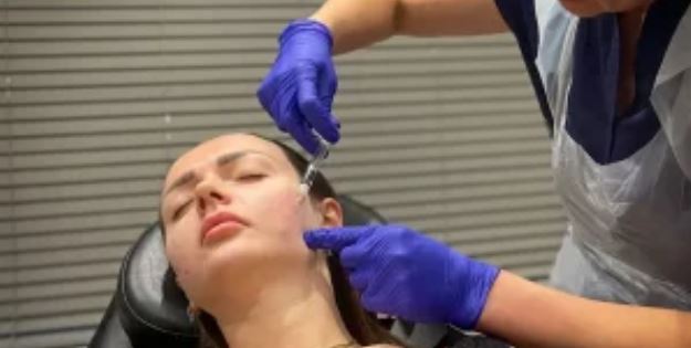 Hiqni dorë nga fillerat – ja pse njerëzit po bëjnë injeksione në fytyrë të bëra nga sperma e peshkut