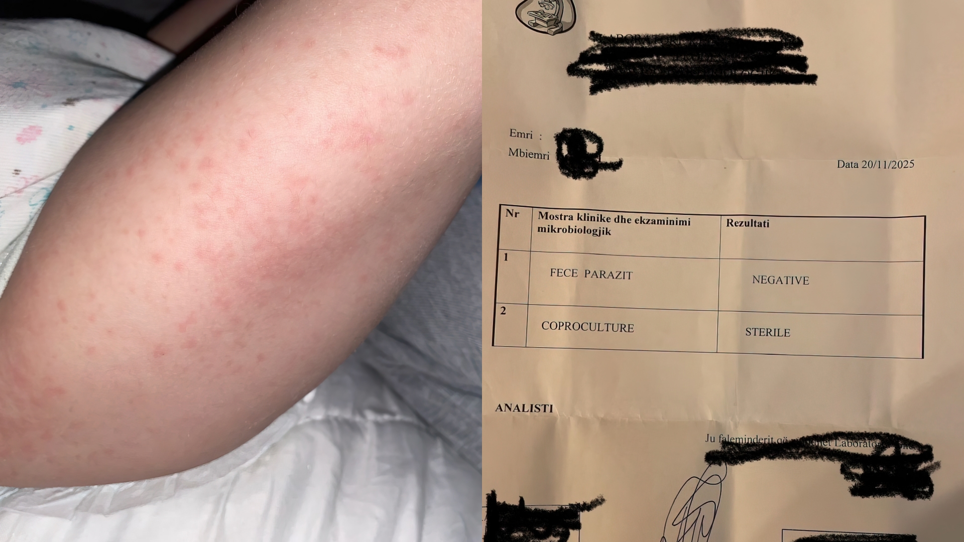 Nëna ngre shqetësim për kujdesin pediatrik: “Prindër, bëni kujdes me mjekët që ndjekin fëmijët tuaj”