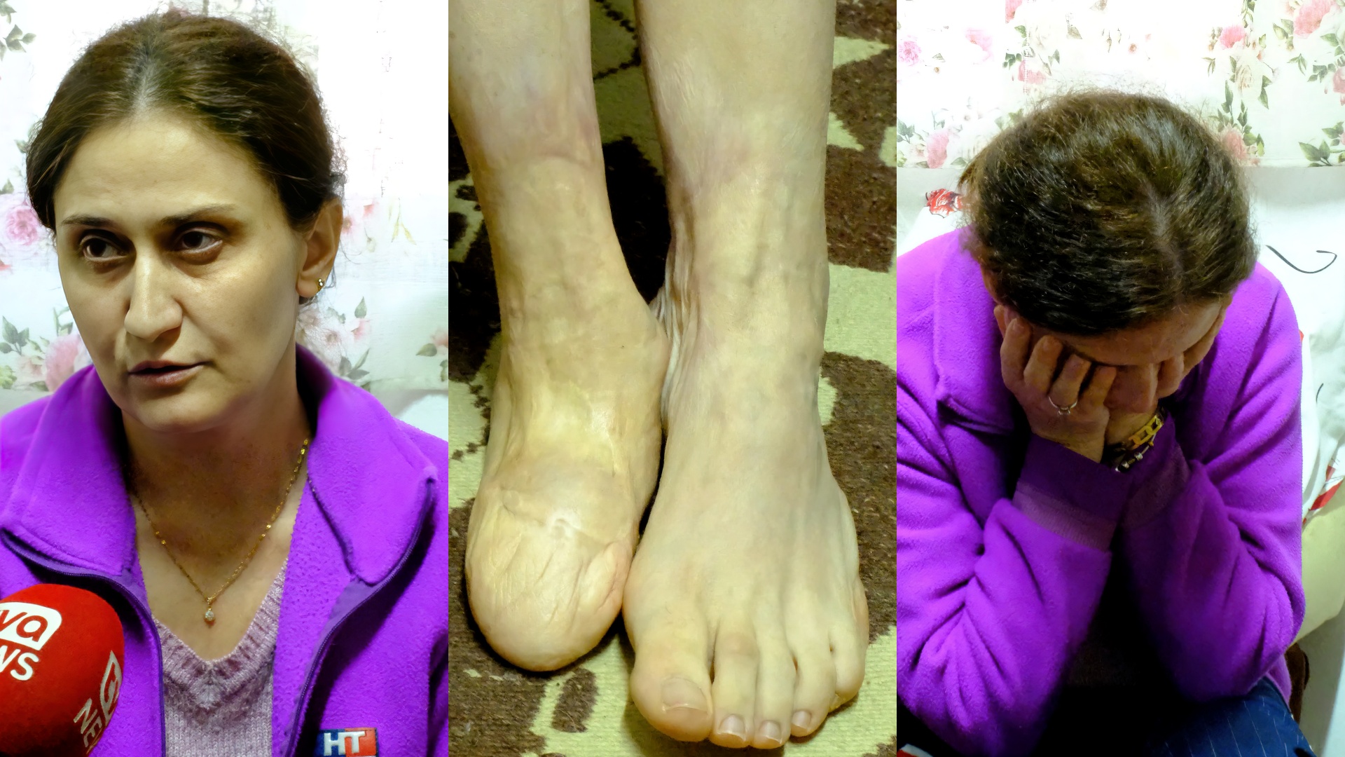 Një operacion do t’i ndryshojë jetën, ta ndihmojmë Fatmirën