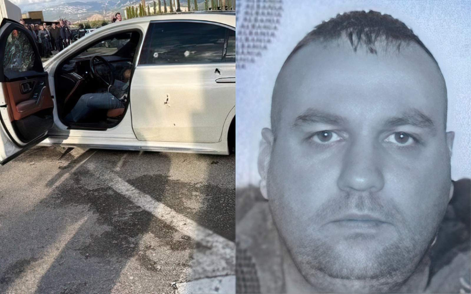 Muçi Shaljani mori 10 plumba në trup  ndodhet në gjendje të rëndë te Trauma