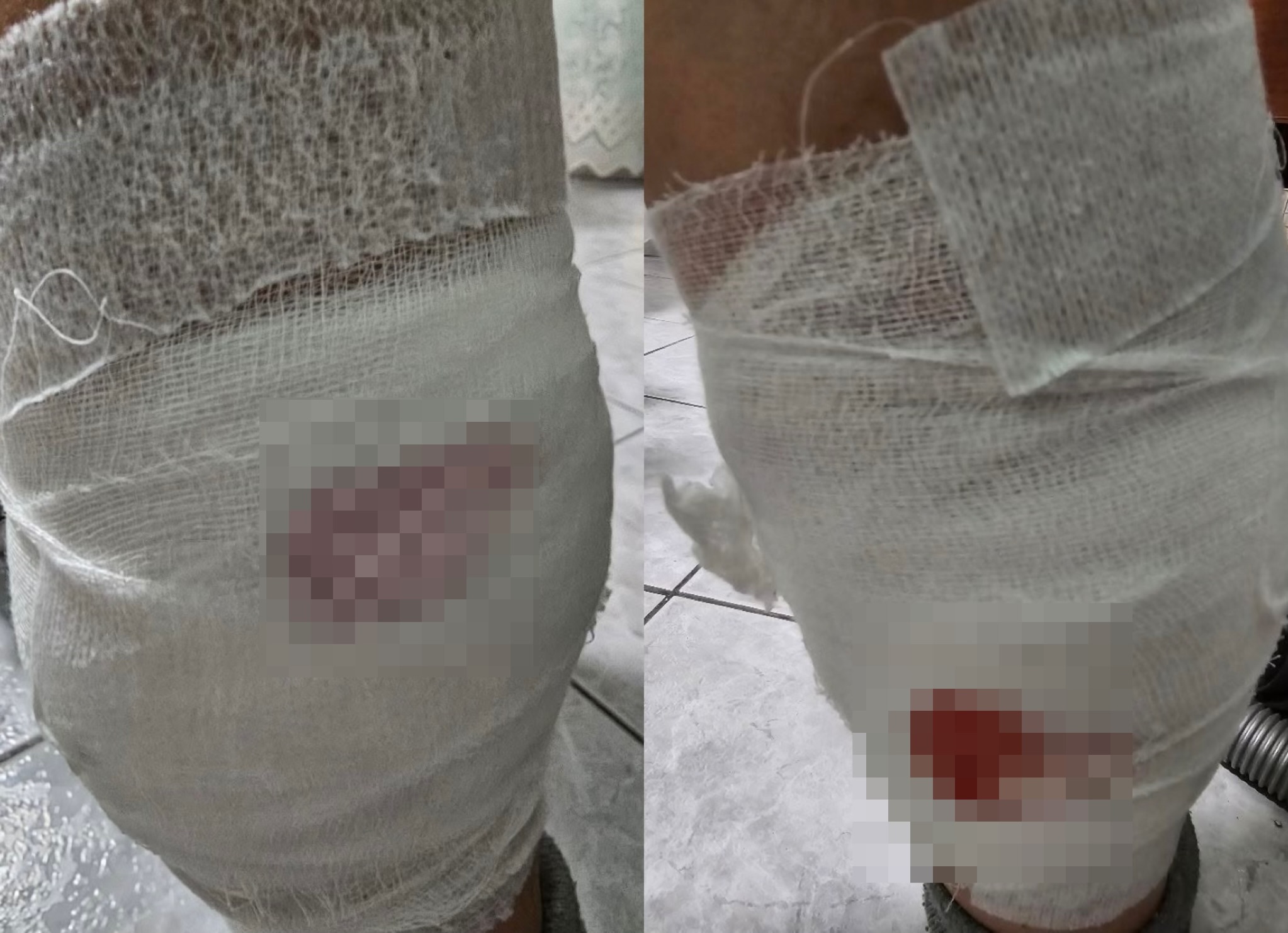 Qentë endacakë po bëjnë namin në Vlorë, në farmaci mungon vaksina e tetanosit