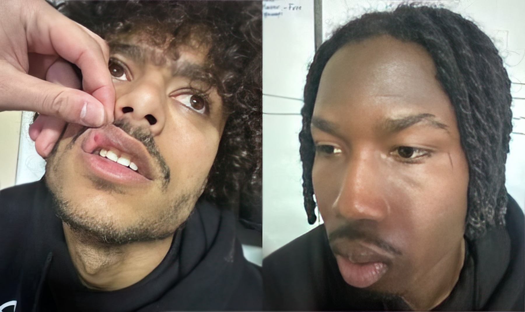 Dy lojtarët e Skënderbeut me të çara në fytyrë  u dhunuan para ndeshjes