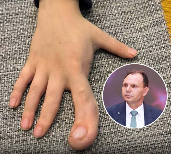  Golden Eagle  dhuron 5000 euro për operimin e vogëlushit 6 vjeçar