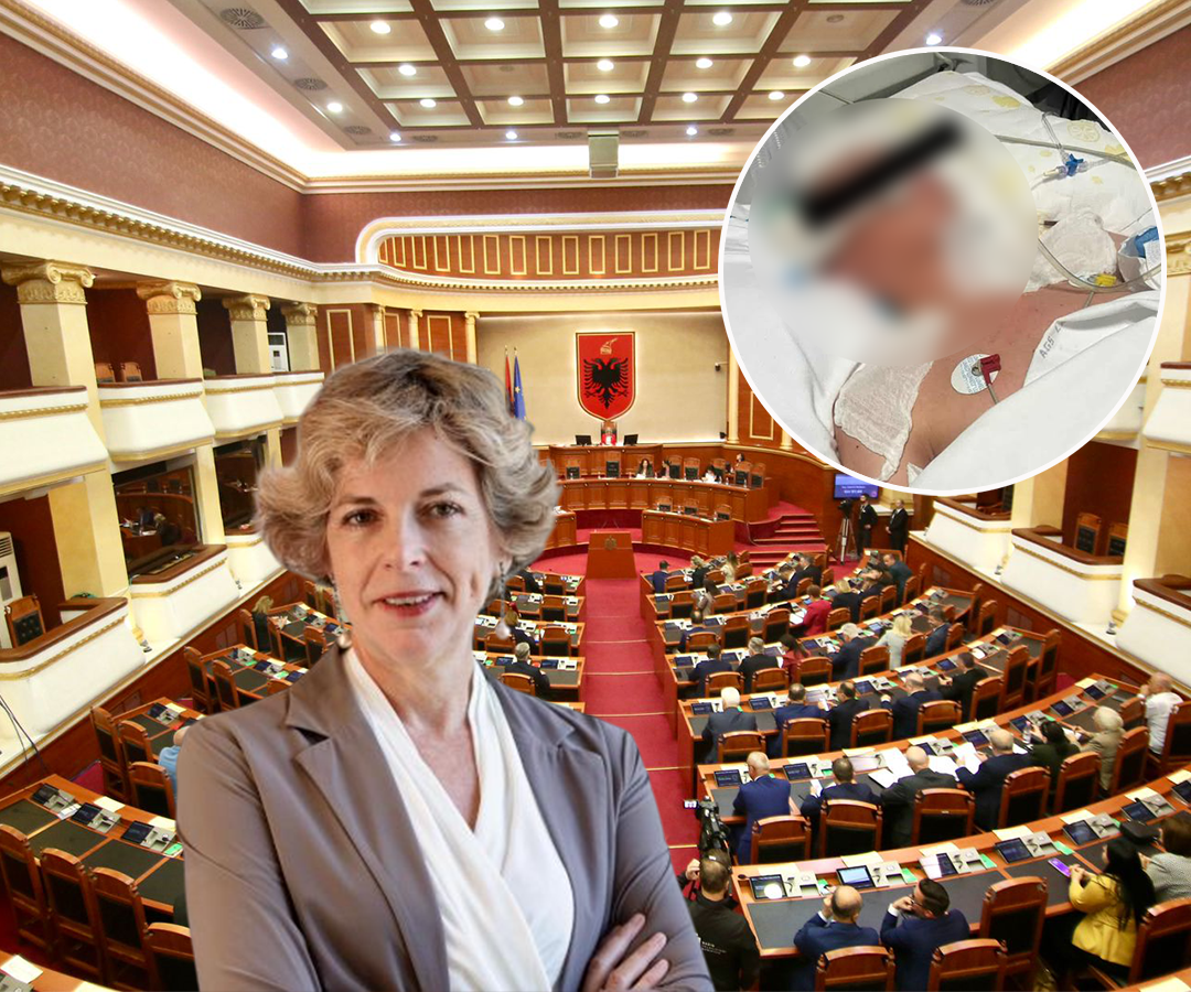 9 ditë në intubim  Shteti e la të vdiste  Erioni humbi jetën se nuk ishte djal deputeti