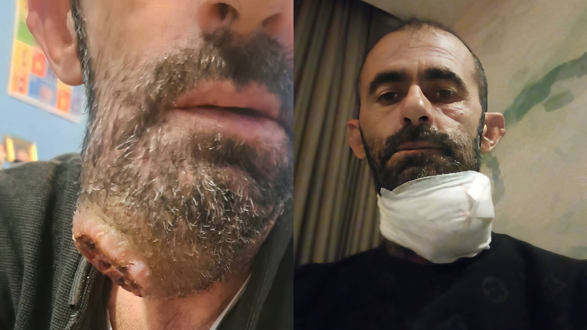 Tumori po i rrezikon jetën, Ridvani nga Vlora ka nevojë për ne