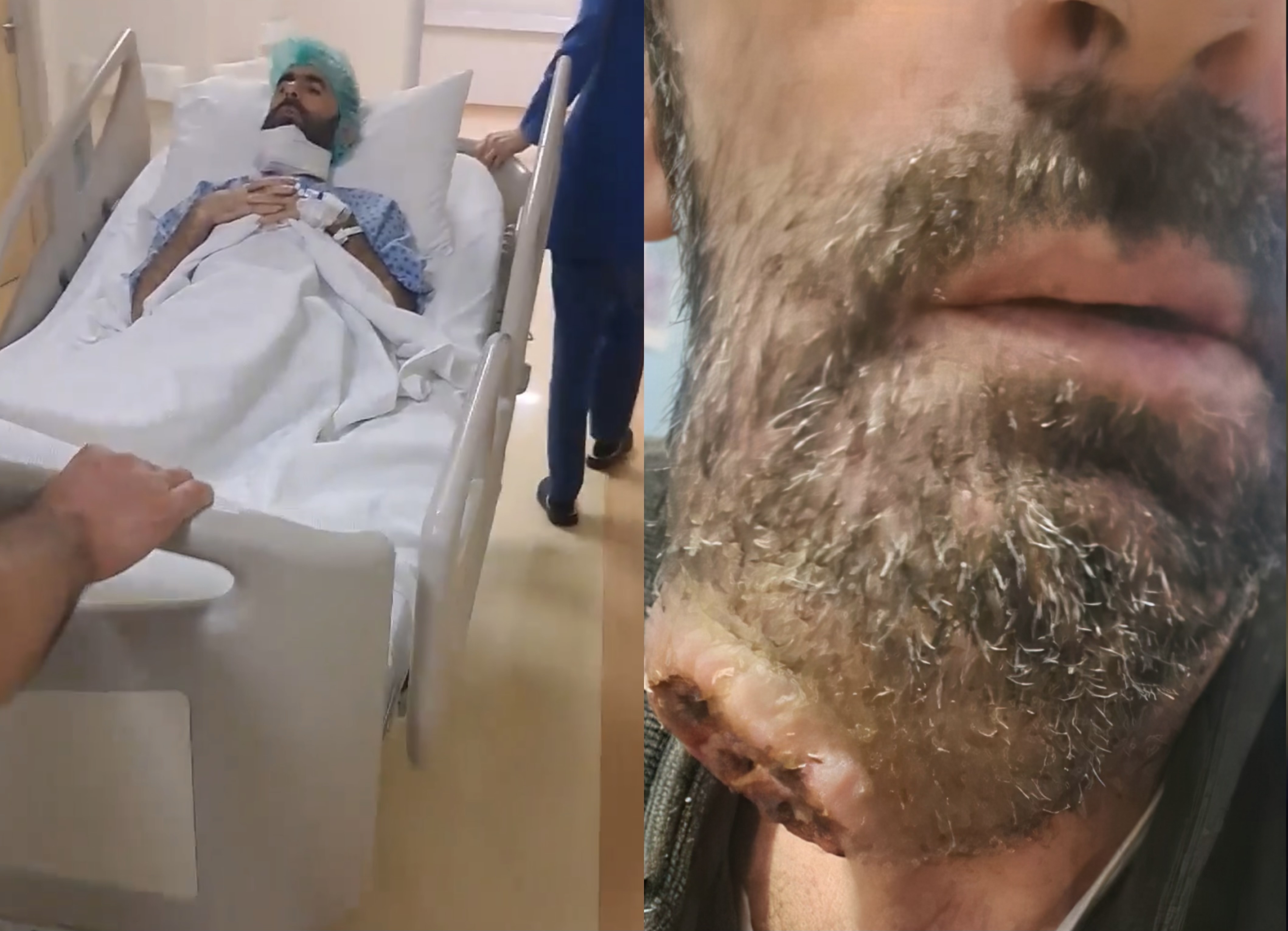 Ndihmat u mblodhën në kohë rekord  Ridvani futet në operim pas apelit në JOQ