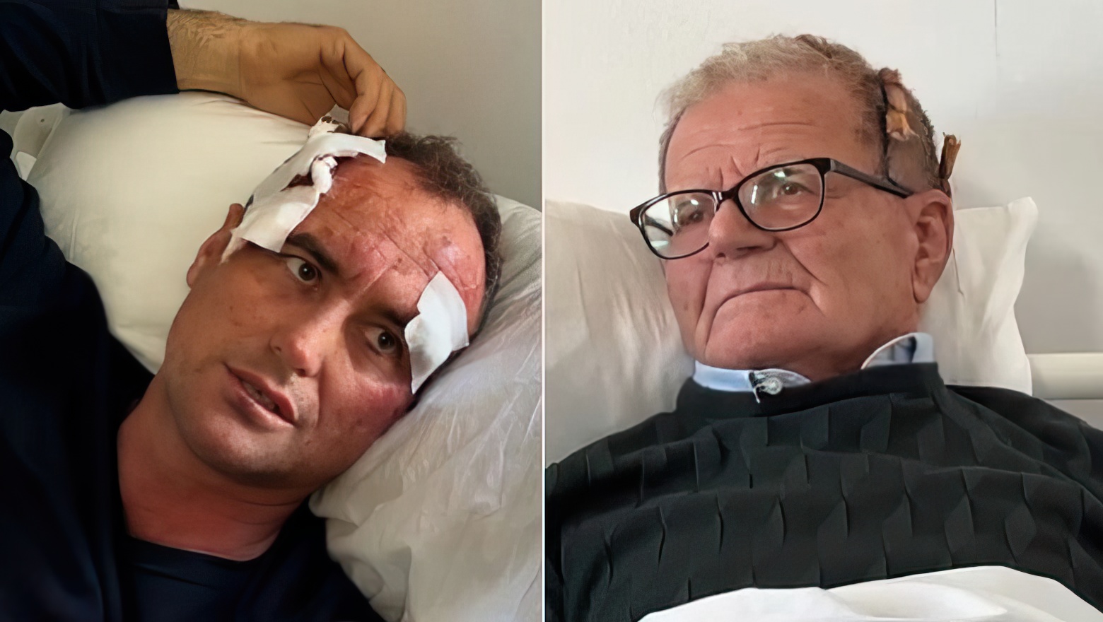 Polici i Fierit bën për spital 46 vjeçarin  Pse i bëre  like  motrës sime 