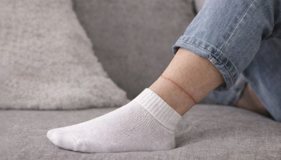 Nëse çorapet ju lënë shenja të thella në këmbë, nuk është rastësi: Ja çfarë po sinjalizon trupi