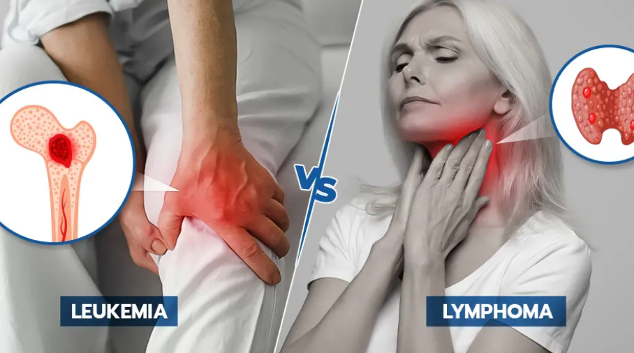Leukemia dhe limfoma: Si dallojnë, simptomat dhe faktorët kryesorë të rrezikut