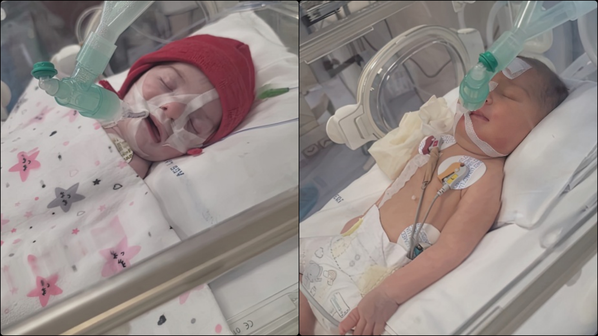 Thirrje urgjente për Meilin, bebushja 1 muajshe po lufton për jetën