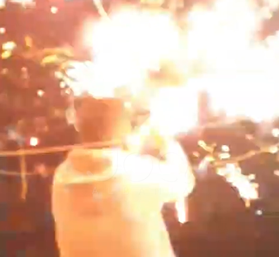  Më mbrojti Zoti   të riut i shpërthen fishekzjarri në dorë gjatë festimeve të Vitit të Ri