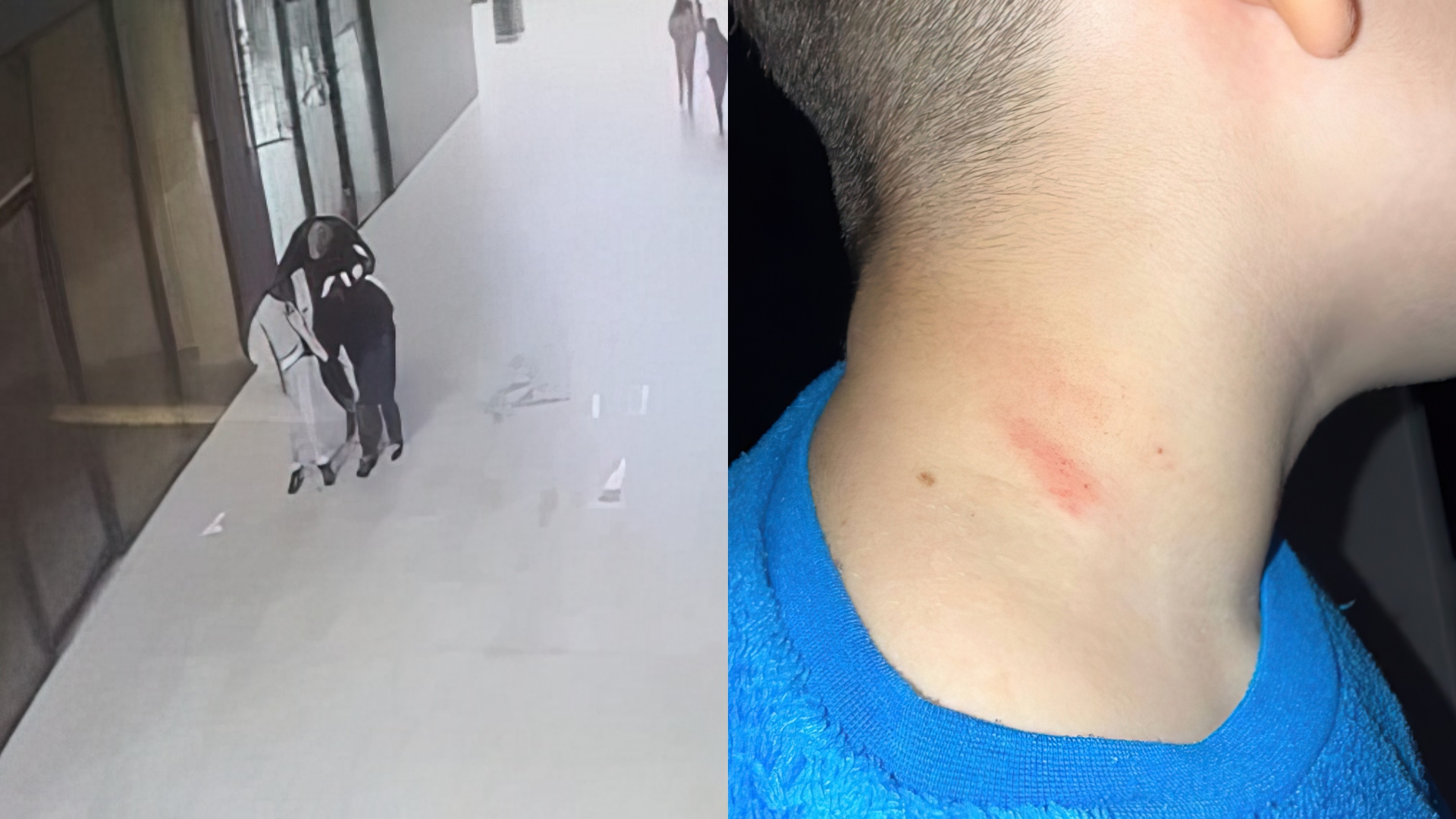 Burri në Yzberisht rreh dy 10 vjeçarët se hodhën kapsolla