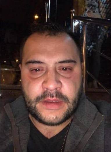 U kap duke vënë 20 000€ gjobë  arrestohet gazetari Elio Laze