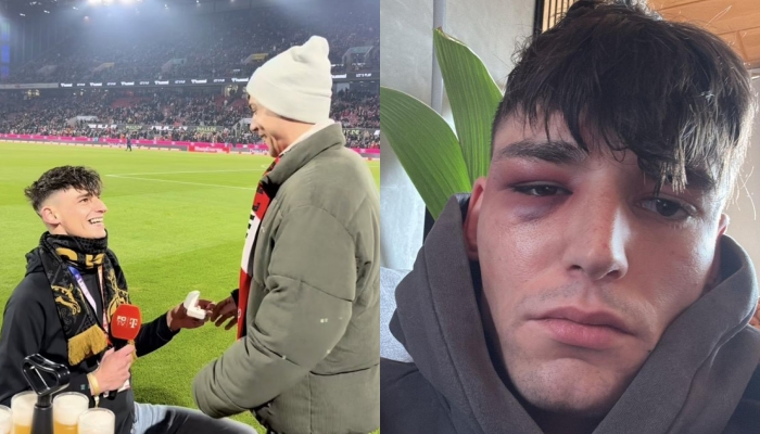 I propozoi të dashurit para 50 mijë tifozëve  dhunohet arbitri gjerman