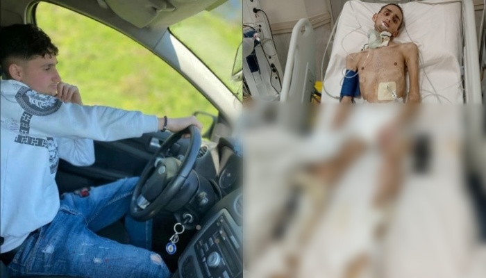 Kërkoi ndihmë për t’u shëruar, 19-vjeçari Drilon humb betejën për jetën