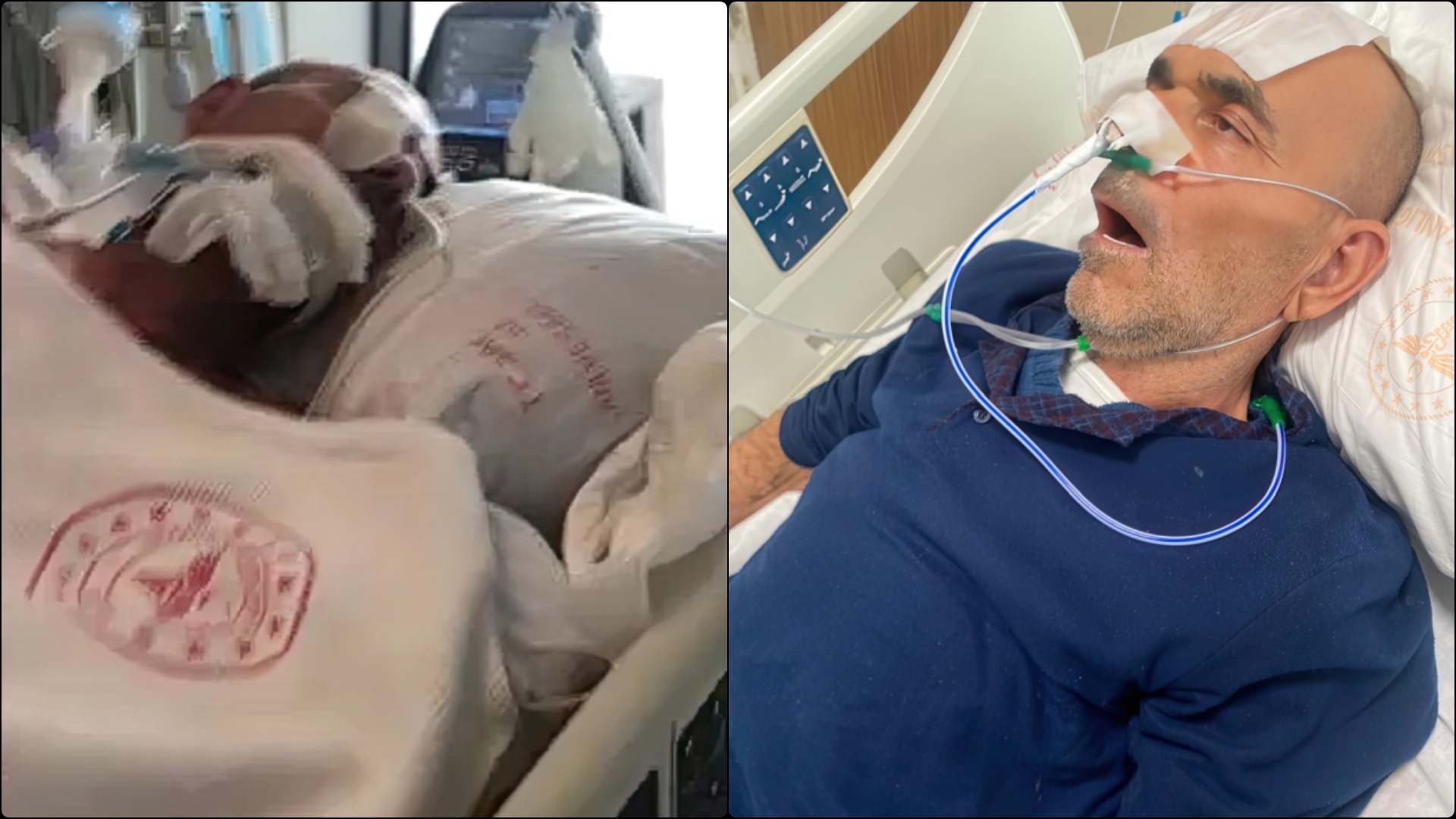 Apel për ndihmë/ Babai në koma prej 28 dhjetorit në spitalin e Turqisë, familja kërkon mbështetje për përballimin e kostove