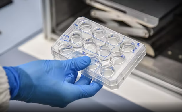 Shqiptarja në Itali vdes pas diagnozës së gabuar  300 mijë € dëmshpërblim për familjen