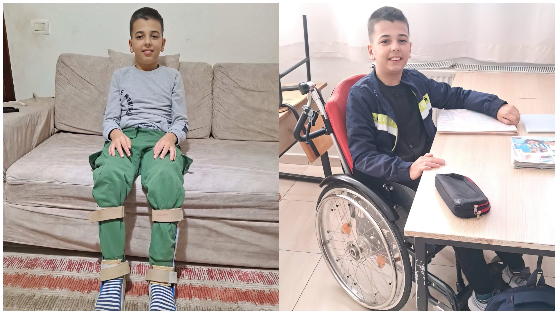 Mjekimi i gabuar i ndryshoi jetën  le të ndihmojmë Arlindin 11 vjeç të ecë si moshatarët