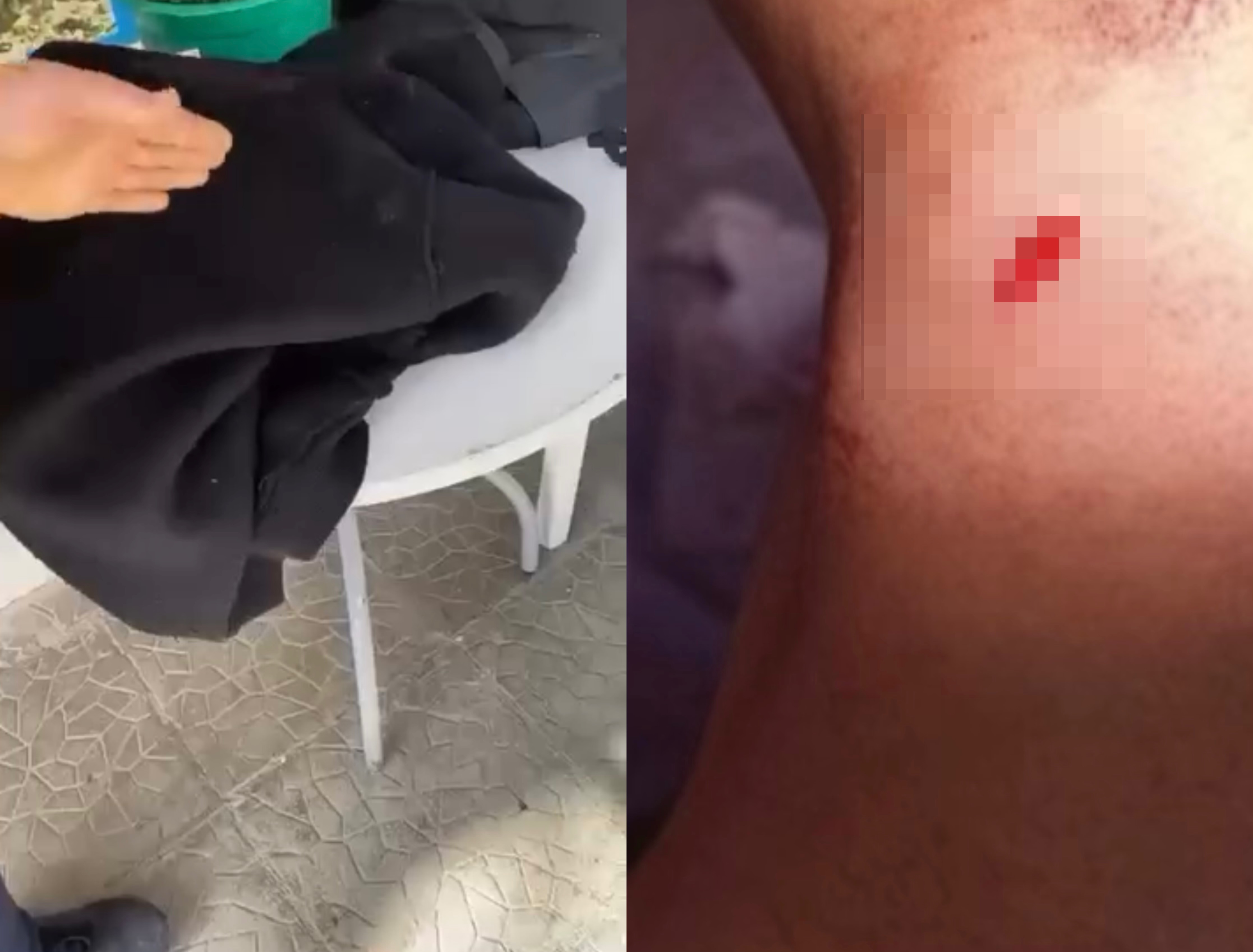 Sherri mes nxënësve në Delvinë nisi në shkollë  I mituri e goditi 16 vjeçarin 4 herë në kurriz me thikë