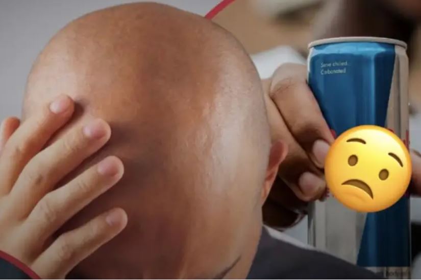 Lëngjet energjike dhe pijet e gazuara rrisin rënien e flokëve dhe ankthin te meshkujt