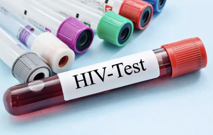 Rritje alarmante e HIV në Shqipëri  të rinjtë ndër më të prekurit