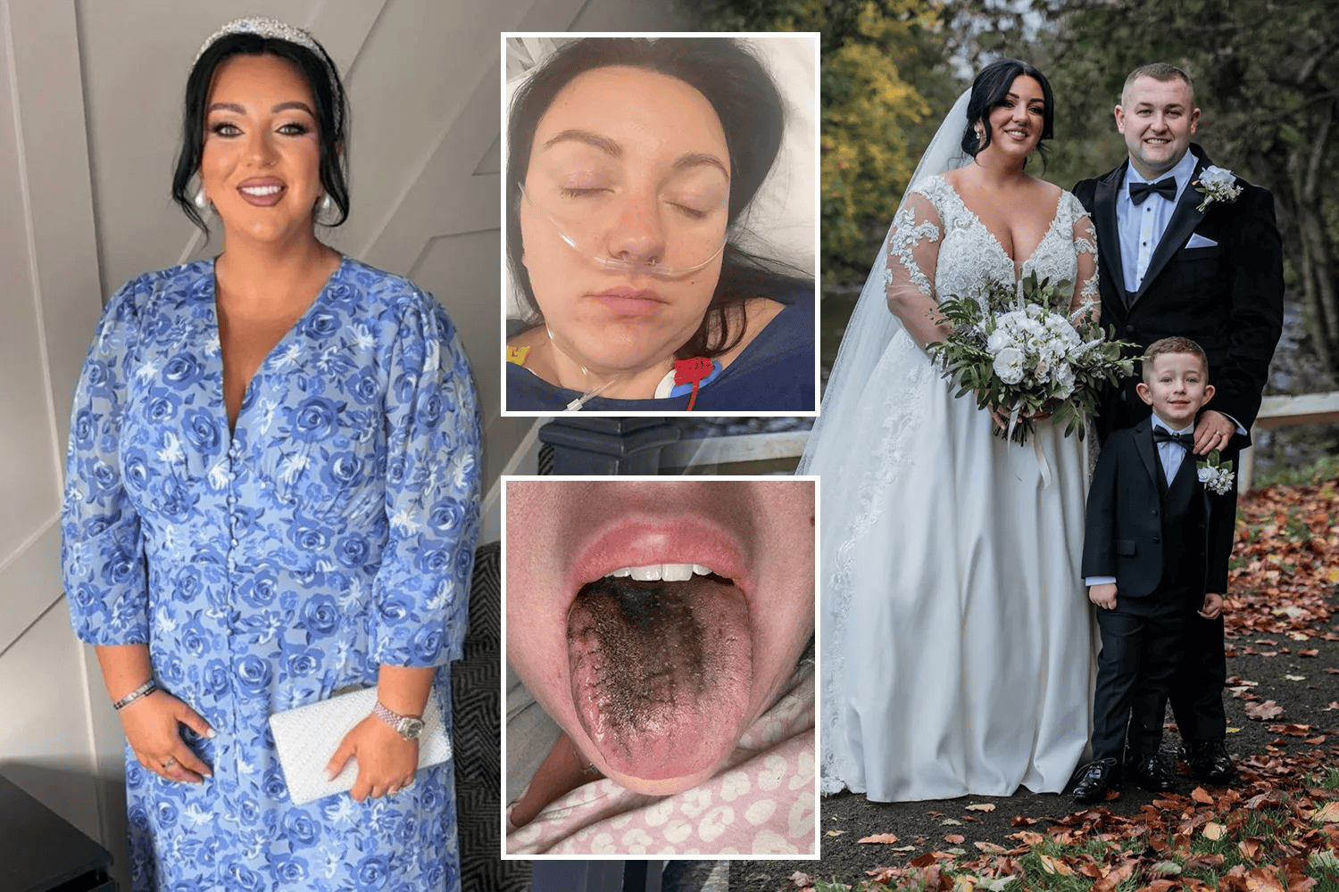 Mori injeksionin për humbje peshe  gruas i nxihet gjuha dhe përfundon duke hequr tëmthin