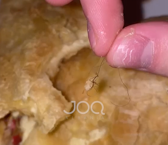 “Gjeta qime floku në byrek, s’është hera e parë që ndodh”