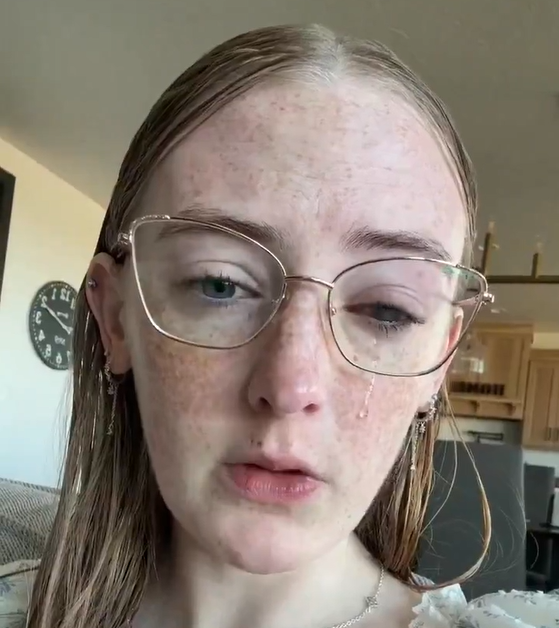 Bënte dush pa hequr lentet e kontaktit  20 vjeçarja humb plotësisht shikimin