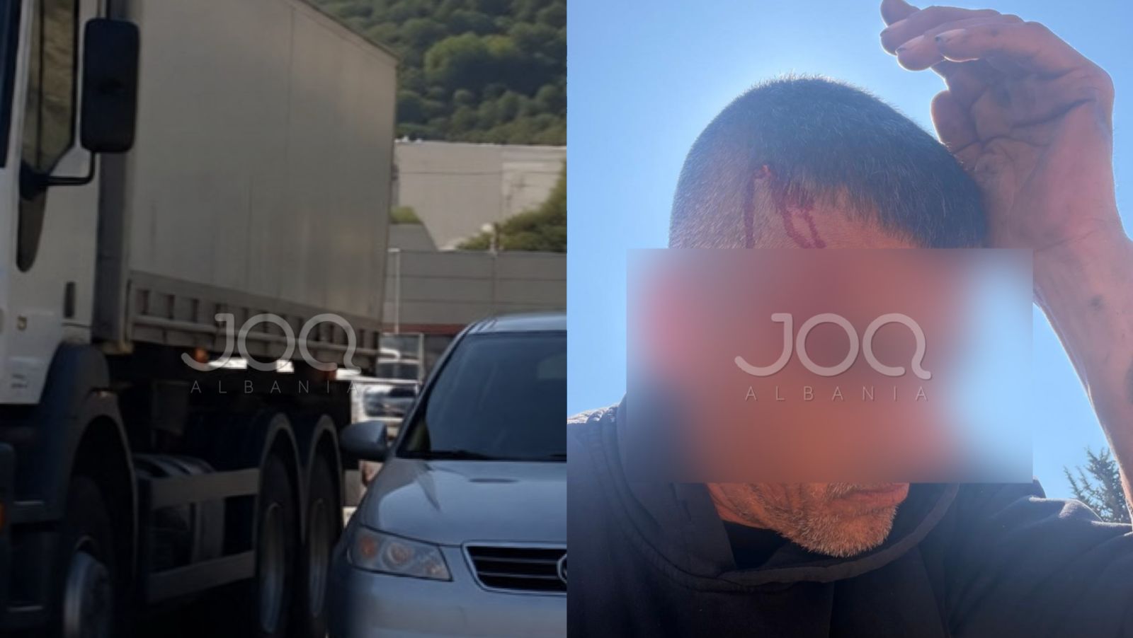 U denoncua në JOQ për parakalim të rrezikshëm  reagon shoferi   Po humbisja gjak  ambulanca vononte 