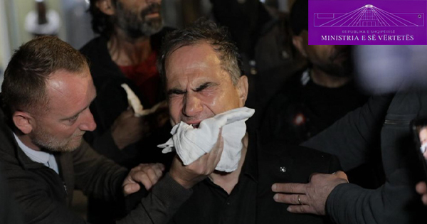 Luçiano Boçi qan me lot për djegien e apartamenteve të qytetarëve tek Arlis