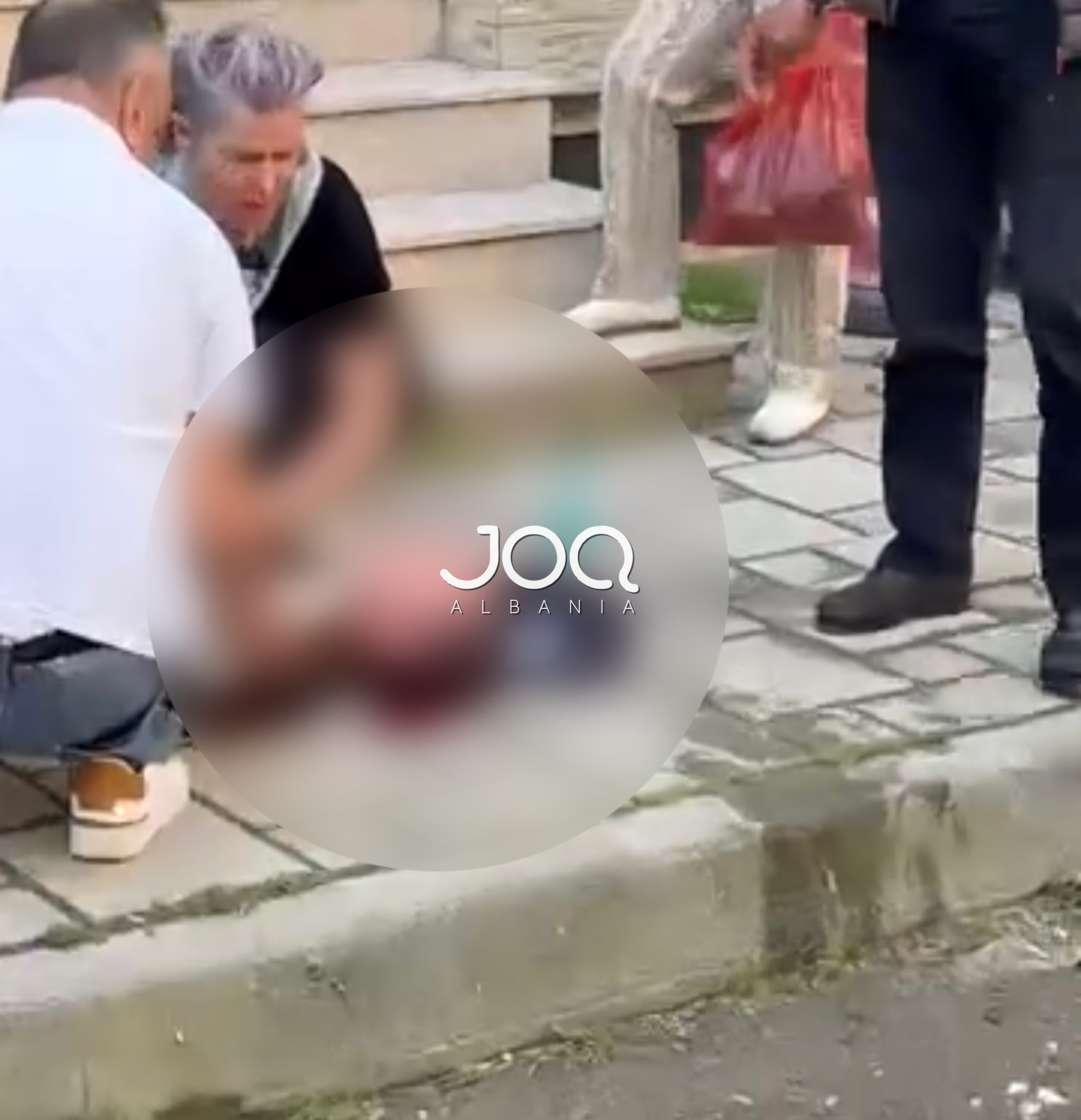 Kishte luhatje tensioni  qytetari rrëzohet në mes të rrugës dhe pëson gjakderdhje në kokë